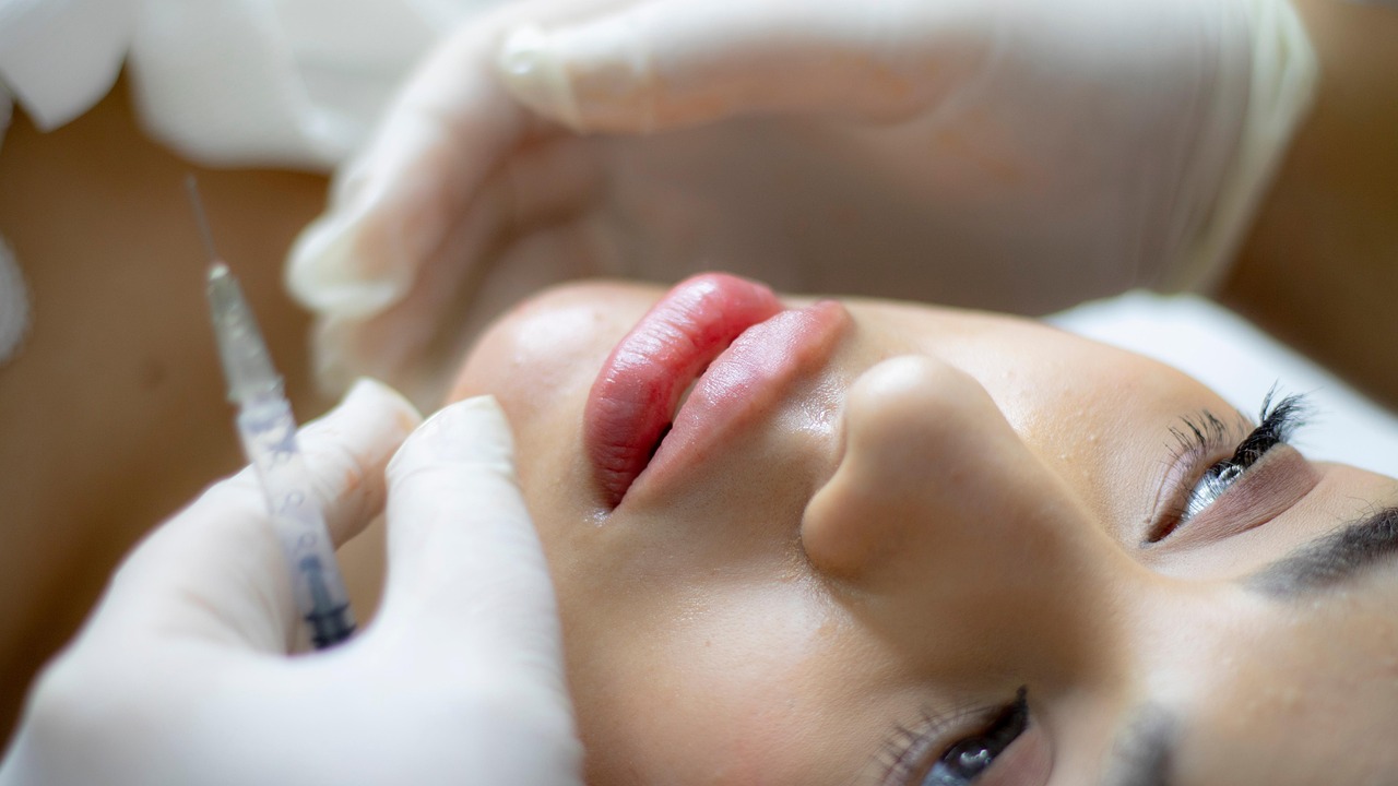 lip filler, beauty, injection, filler, lip augmentation, dermatology, cosmetics, face, lips, girl, woman, closeup, lip filler, lip filler, lip filler, lip filler, lip filler, filler, filler, filler, dermatology, dermatology, dermatology, dermatology